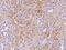 Interferon Induced Protein With Tetratricopeptide Repeats 1 antibody, 202060-T08, Sino Biological, Immunohistochemistry paraffin image 