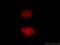 Histone Acetyltransferase 1 antibody, 11432-1-AP, Proteintech Group, Immunofluorescence image 