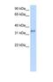 Carbonic Anhydrase 4 antibody, NBP1-69435, Novus Biologicals, Western Blot image 