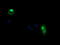 Chaperonin Containing TCP1 Subunit 8 Like 2 antibody, LS-C787543, Lifespan Biosciences, Immunofluorescence image 
