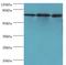 CXXC Finger Protein 1 antibody, MBS1496089, MyBioSource, Western Blot image 