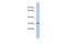 Calcium Voltage-Gated Channel Auxiliary Subunit Gamma 6 antibody, A15264, Boster Biological Technology, Western Blot image 