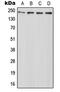 ATP Binding Cassette Subfamily A Member 7 antibody, GTX54901, GeneTex, Western Blot image 