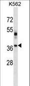 Visual System Homeobox 1 antibody, LS-C160552, Lifespan Biosciences, Western Blot image 