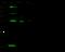 Mitogen-Activated Protein Kinase 13 antibody, GTX02406, GeneTex, Western Blot image 
