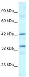 TATA-Box Binding Protein Associated Factor, RNA Polymerase I Subunit A antibody, TA330076, Origene, Western Blot image 