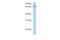 Zinc Finger Protein 418 antibody, 26-559, ProSci, Western Blot image 