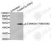 Casein Kinase 2 Alpha 1 antibody, AP0335, ABclonal Technology, Western Blot image 