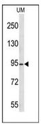 Lysine Acetyltransferase 2A antibody, AP52291PU-N, Origene, Western Blot image 