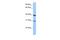 JAZF Zinc Finger 1 antibody, PA5-41686, Invitrogen Antibodies, Western Blot image 
