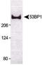 Tumor Protein P53 Binding Protein 1 antibody, PA1-46147, Invitrogen Antibodies, Western Blot image 