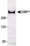 Tumor suppressor p53-binding protein 1 antibody, PA1-46147, Invitrogen Antibodies, Western Blot image 