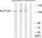 Nucleoporin 160 antibody, LS-C120169, Lifespan Biosciences, Western Blot image 