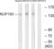 Nuclear pore complex protein Nup160 antibody, LS-C120169, Lifespan Biosciences, Western Blot image 