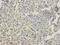 Nudix Hydrolase 1 antibody, A04258-1, Boster Biological Technology, Immunohistochemistry paraffin image 