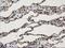 Annexin A3 antibody, LS-C172375, Lifespan Biosciences, Immunohistochemistry paraffin image 