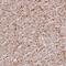 Transformer 2 Alpha Homolog antibody, NBP2-13473, Novus Biologicals, Immunohistochemistry paraffin image 