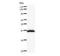 Bromodomain Adjacent To Zinc Finger Domain 1B antibody, LS-C342340, Lifespan Biosciences, Western Blot image 