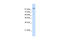 Matrin 3 antibody, ARP40922_T100, Aviva Systems Biology, Western Blot image 