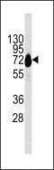 Cadherin 10 antibody, MBS9205843, MyBioSource, Western Blot image 