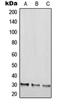 Regulator Of G Protein Signaling 20 antibody, orb215534, Biorbyt, Western Blot image 