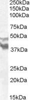 Dynein Axonemal Assembly Factor 4 antibody, MBS421659, MyBioSource, Western Blot image 