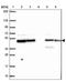 DnaJ Heat Shock Protein Family (Hsp40) Member A2 antibody, NBP2-32551, Novus Biologicals, Western Blot image 