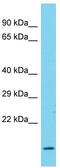 Sorting Nexin 22 antibody, TA331679, Origene, Western Blot image 