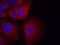 Glycogen Synthase Kinase 3 Alpha antibody, GTX50368, GeneTex, Immunofluorescence image 