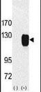 Receptor Tyrosine Kinase Like Orphan Receptor 1 antibody, PA5-14725, Invitrogen Antibodies, Western Blot image 