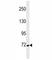 Cortactin antibody, F53608-0.1ML, NSJ Bioreagents, Western Blot image 