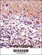 Cerebellar Degeneration Related Protein 2 antibody, 58-041, ProSci, Immunohistochemistry paraffin image 