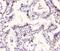 CD49c antibody, A02902, Boster Biological Technology, Immunohistochemistry paraffin image 