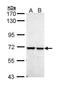 Peptidylprolyl Isomerase Like 2 antibody, GTX111142, GeneTex, Western Blot image 