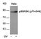 Ribosomal Protein S6 Kinase A1 antibody, PA5-37730, Invitrogen Antibodies, Western Blot image 