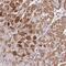 Mitochondrial Ribosomal Protein S31 antibody, PA5-61219, Invitrogen Antibodies, Immunohistochemistry frozen image 