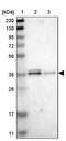 Secretory Carrier Membrane Protein 2 antibody, PA5-53949, Invitrogen Antibodies, Western Blot image 