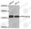 Serine/threonine-protein phosphatase 2A regulatory subunit B subunit alpha antibody, A4036, ABclonal Technology, Western Blot image 