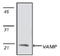 Vesicle Associated Membrane Protein 1 antibody, GTX18013, GeneTex, Western Blot image 