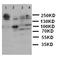 Laminin Subunit Gamma 2 antibody, LS-C312738, Lifespan Biosciences, Western Blot image 
