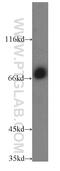 Centrosomal Protein 72 antibody, 19928-1-AP, Proteintech Group, Western Blot image 