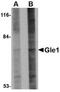 Nucleoporin GLE1 antibody, NBP1-76979, Novus Biologicals, Western Blot image 