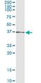 Aldo-Keto Reductase Family 7 Member A2 antibody, MA5-20447, Invitrogen Antibodies, Immunoprecipitation image 