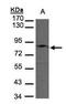 GIT ArfGAP 1 antibody, GTX105824, GeneTex, Western Blot image 