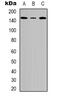 Tensin 2 antibody, abx133597, Abbexa, Western Blot image 