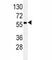 Serpin Family A Member 9 antibody, F40214-0.4ML, NSJ Bioreagents, Western Blot image 