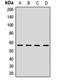 3-Hydroxy-3-Methylglutaryl-CoA Synthase 1 antibody, LS-C667851, Lifespan Biosciences, Western Blot image 