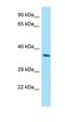 Retinol Dehydrogenase 8 antibody, orb326534, Biorbyt, Western Blot image 