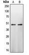 Caspase 9 antibody, orb213662, Biorbyt, Western Blot image 