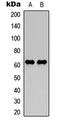 Neurofilament Light antibody, LS-C358819, Lifespan Biosciences, Western Blot image 